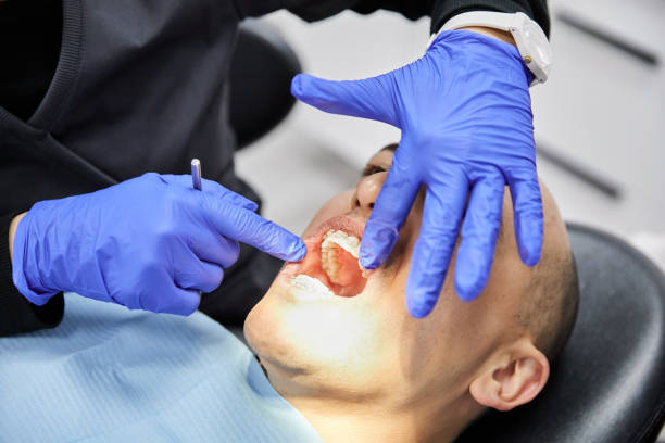 Best Emergency Root Canal Treatment in Bel Ridge, MO