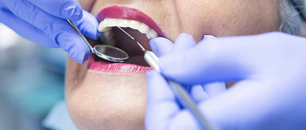 Fast & Reliable Emergency Dental Services in MO